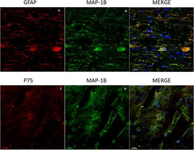 Single vs. Combined Therapeutic Approaches in Rats With Chronic Spinal Cord Injury